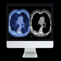 Practical PET CT What You Need to Know 2020 Course_Video - کتاب پزشکی بهار