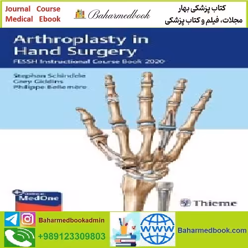 Arthroplasty in Hand Surgery TRUE PDF price 1€