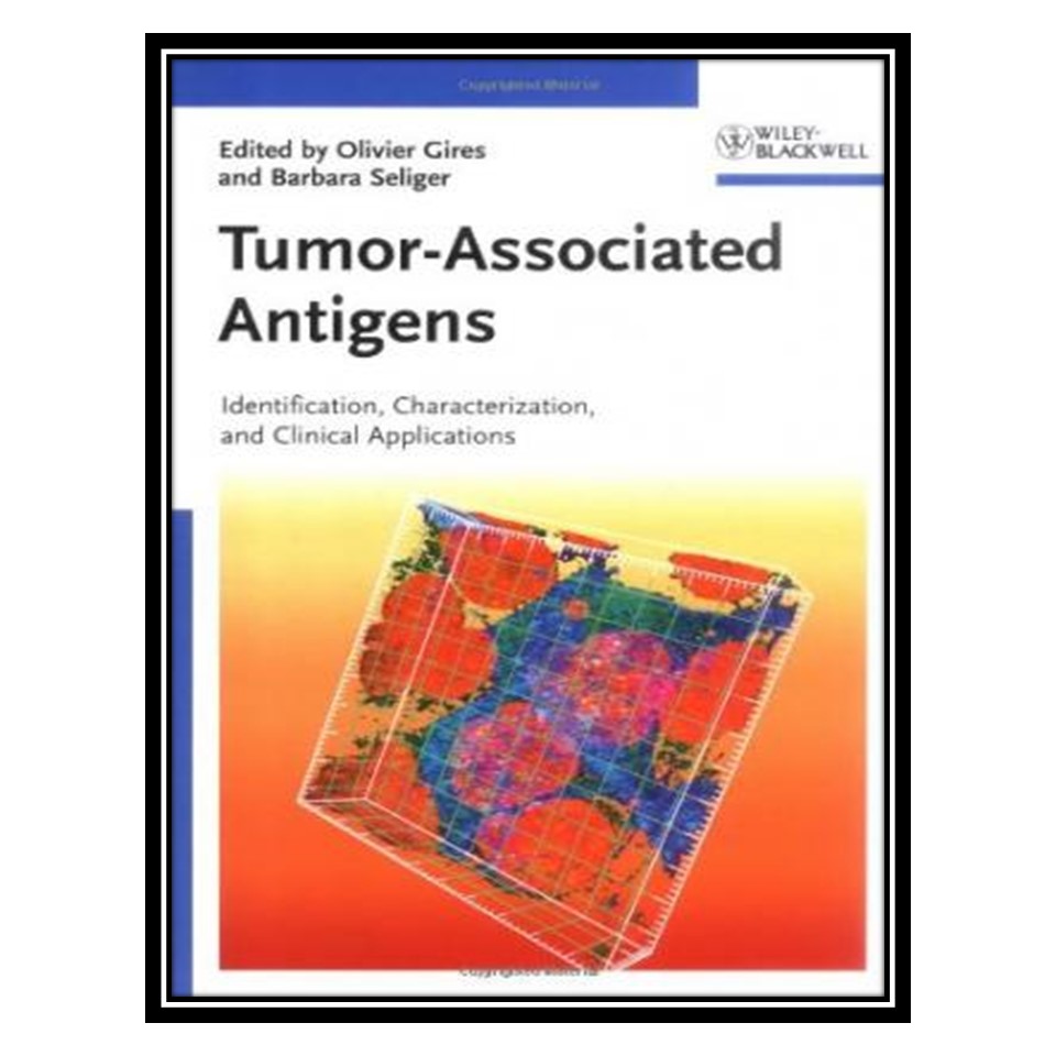کتاب Tumor-Associated Antigens: Identification, Characterization, and Clinical Applications اثر Olivier Gires and Barbara Seliger انتشارات مؤلفین طلایی