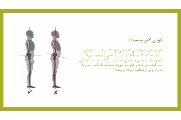 پاورپوینت گودی کمر و حرکات اصلاحی آن برای ارائه ورزش - کتابخانه مجازی واتیکان