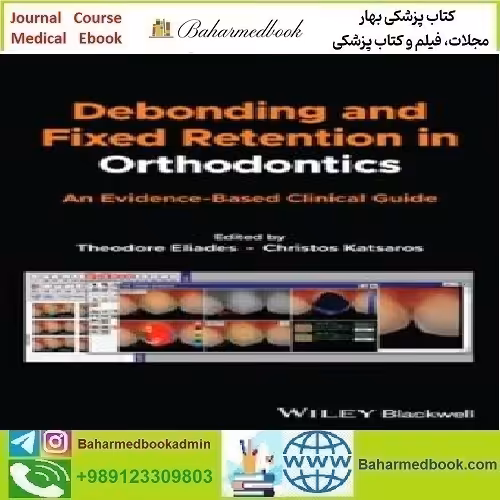 Debonding and Fixed Retention in Orthodontics 2024