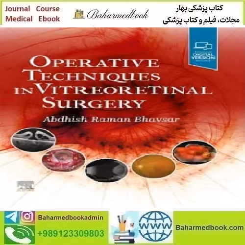 Operative Techniques in Vitreoretinal Surgery Video