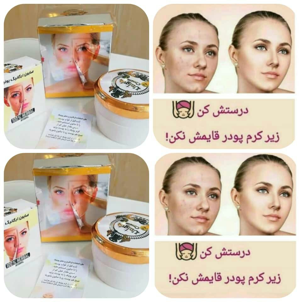 کرم  یونیک  اصل