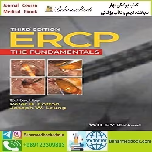 ERCP The Fundamentals 2020 TRUE PDF price 1€ - کتاب پزشکی بهار