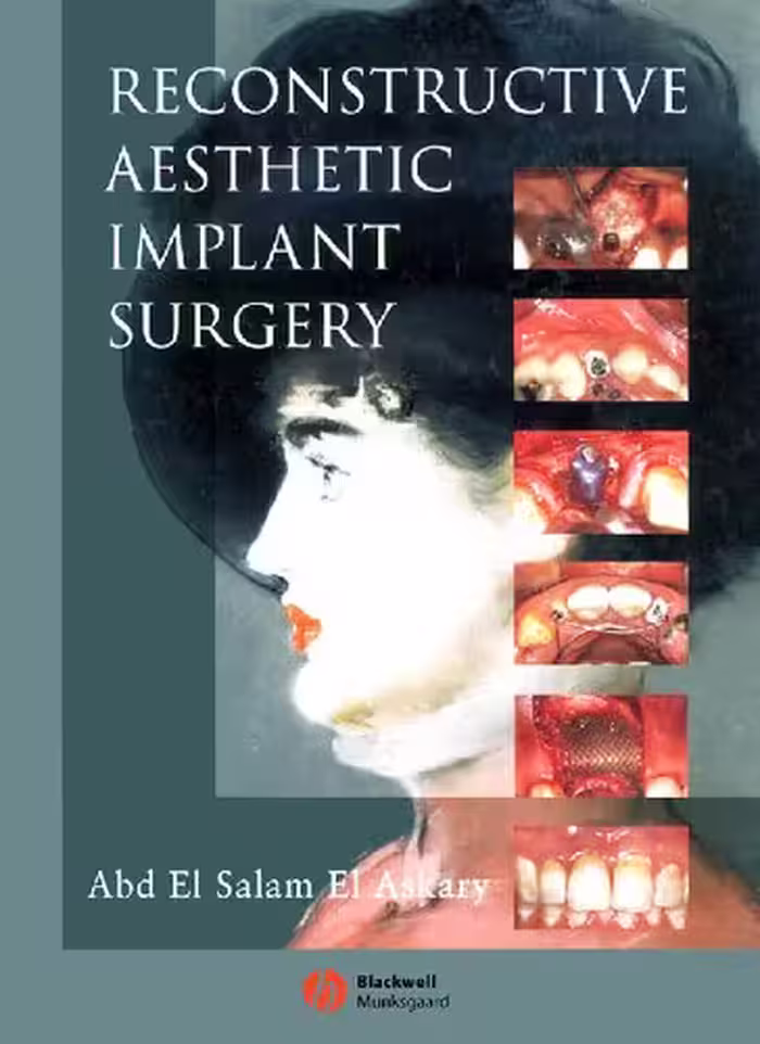 󾕇 دانلود کتاب Reconstructive Aesthetic Implant Surgery, 2003 - دانلود کتاب های دانشگاهی