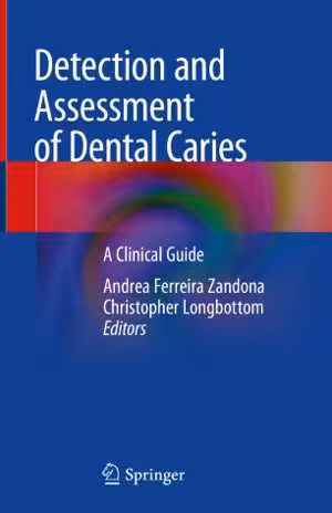 [PDF] دانلود کتاب Detection And Assessment Of Dental Caries - A Clinical Guide, 2019