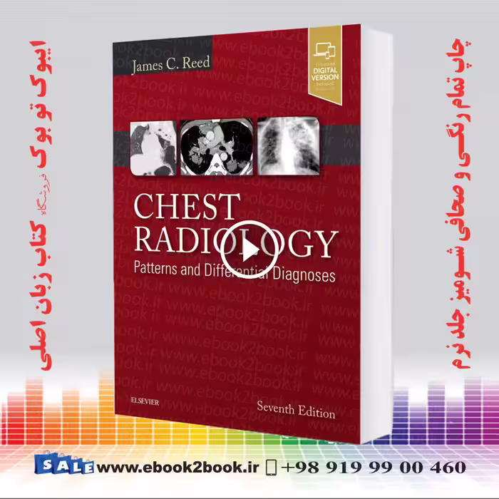Chest Radiology: Patterns and Differential Diagnoses 7th Edition