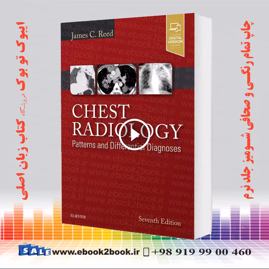 Chest Radiology: Patterns and Differential Diagnoses 7th Edition