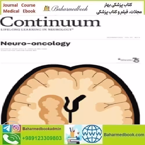 CONTINUUM Lifelong Learning in Neurology Neuro oncology