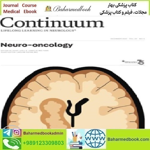 CONTINUUM Lifelong Learning in Neurology Neuro oncology