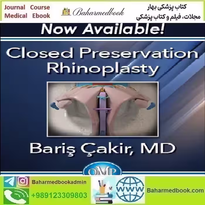 Quality Medical Publishing Closed Preservation Rhinoplasty 2023