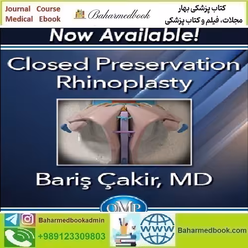 Quality Medical Publishing Closed Preservation Rhinoplasty 2023