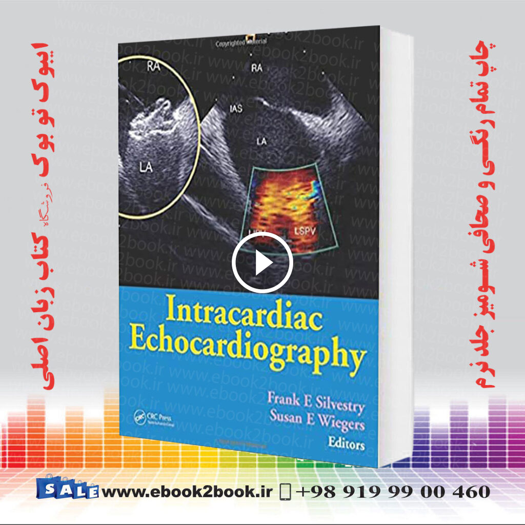 Intracardiac Echocardiography