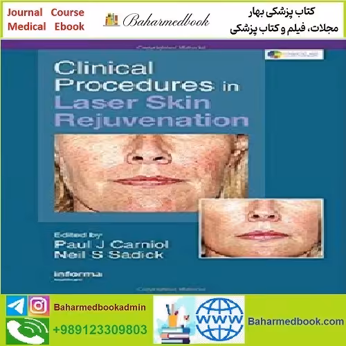 Clinical Procedures in Laser Skin Rejuvenation TRUE PDF price 1€