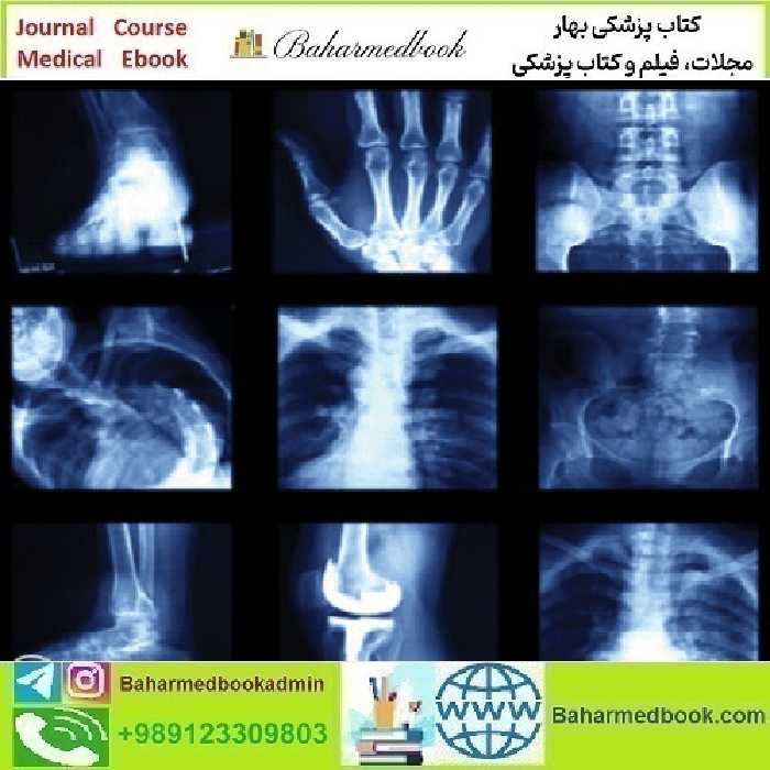 UCSF Imaging Core and Extremities 2024 video course price 35€ - کتاب پزشکی بهار