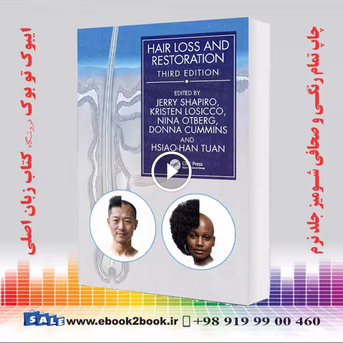 Hair Loss and Restoration 3rd Edition