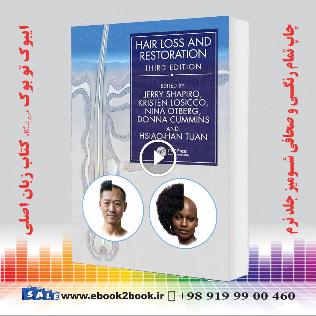Hair Loss and Restoration 3rd Edition