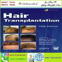 Hair Transplantation TRUE PDF price 1€ - کتاب پزشکی بهار