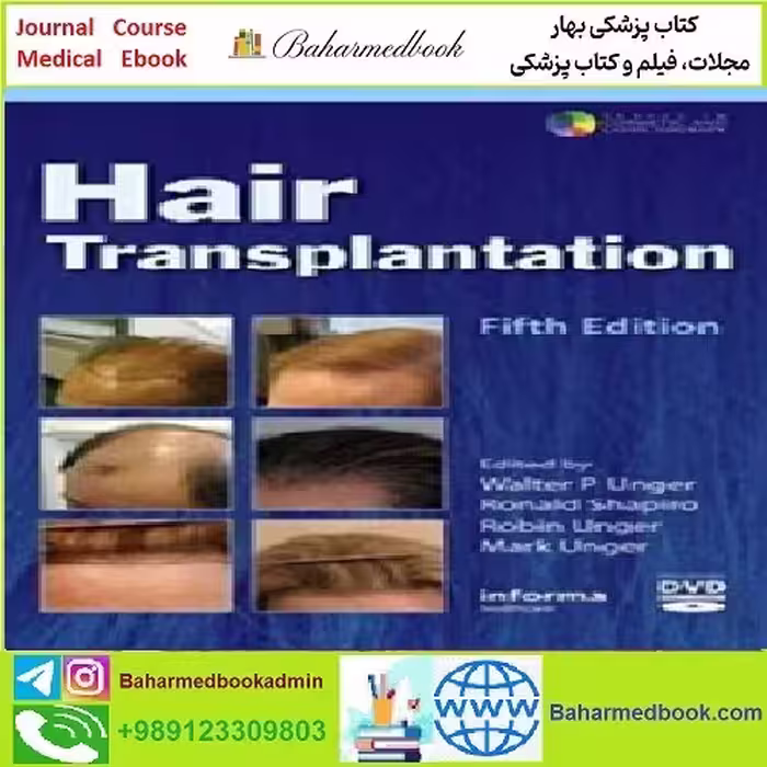 Hair Transplantation TRUE PDF price 1€ - کتاب پزشکی بهار