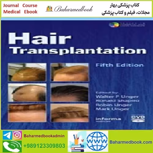Hair Transplantation TRUE PDF price 1€ - کتاب پزشکی بهار