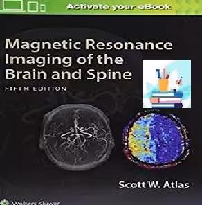 Magnetic Resonance Imaging of the Brain and Spine Convertef