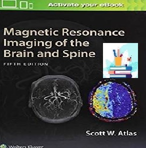 Magnetic Resonance Imaging of the Brain and Spine Convertef