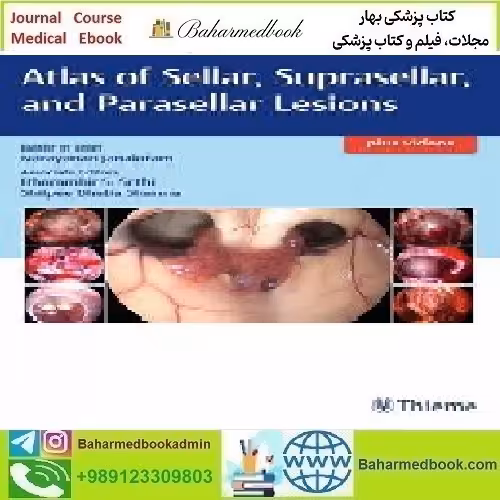 Atlas of Sellar Suprasellar and Parasellar Lesions 2019