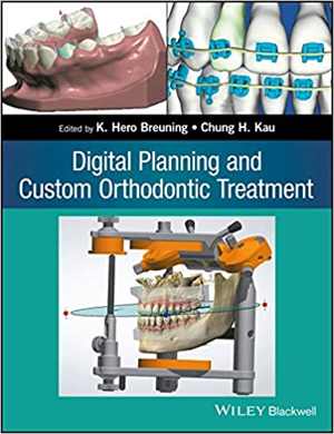[PDF] دانلود کتاب Digital Planning And Custom Orthodontic Treatment, 2017