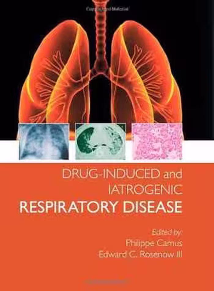[PDF] دانلود کتاب Drug Induced And Iatrogenic Lung Disease, 2010