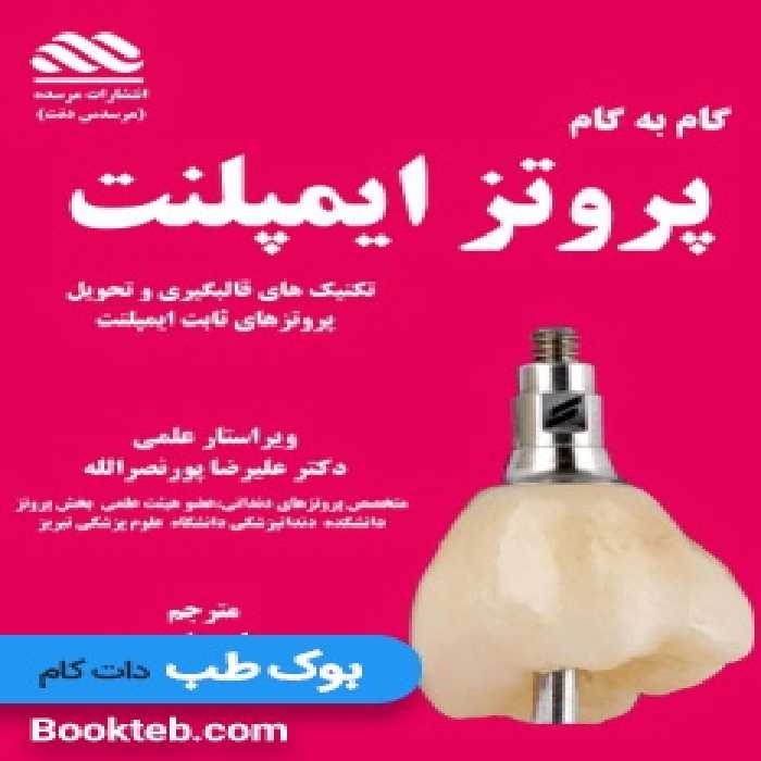 گام به گام پروتز های ایمپلنت دندان، قالبگیری و تحویل پروتزهای ثابت ایمپلنت (همراه با ویدیوی آموزشی)