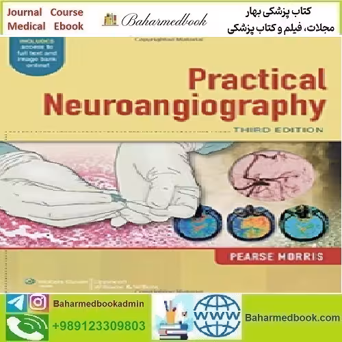 Practical Neuroangiography 2013 TRUE PDF price 1€ - کتاب پزشکی بهار