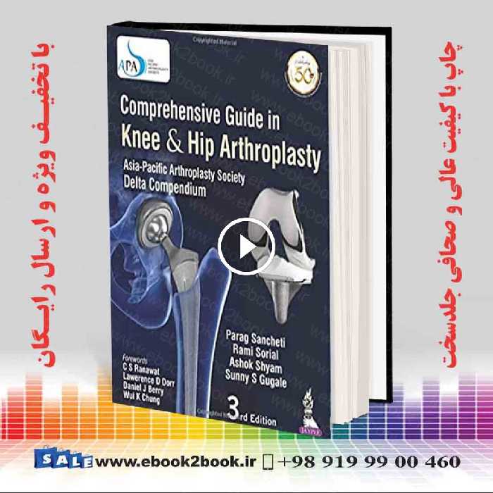 Comprehensive Guide In Knee & Hip Arthroplasty