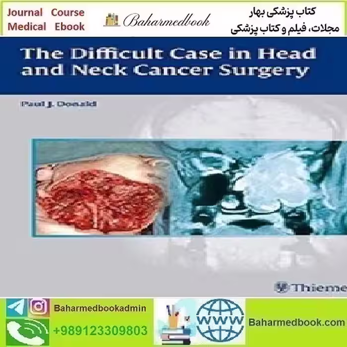The Difficult Case in Head and Neck Cancer Surgery