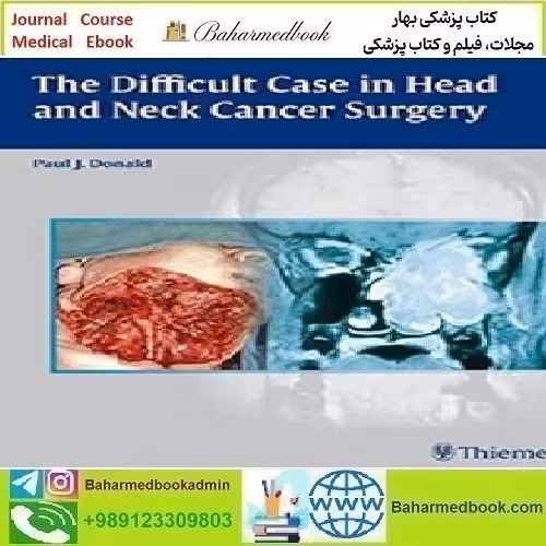 The Difficult Case in Head and Neck Cancer Surgery