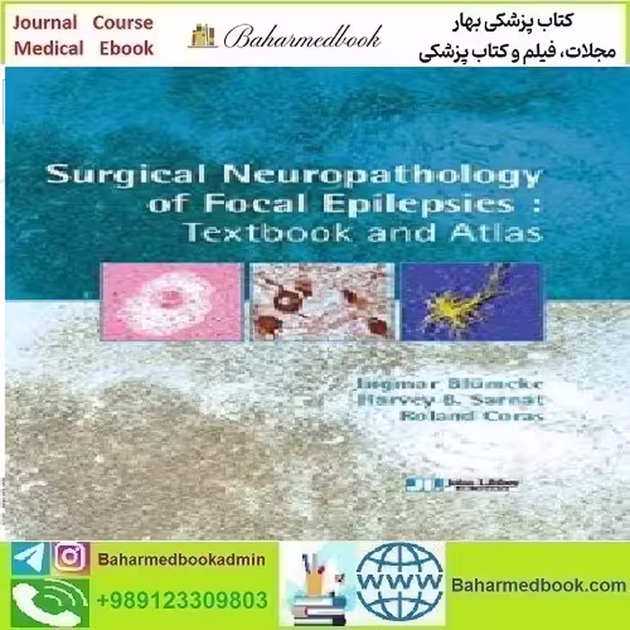 Surgical Neuropathology of Focal Epilepsies 2015 TRUE PDF p