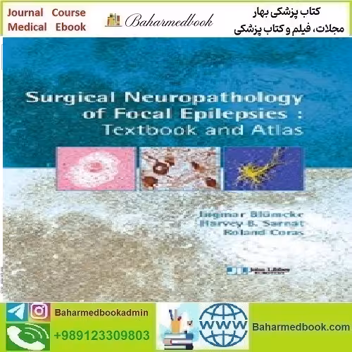 Surgical Neuropathology of Focal Epilepsies 2015 TRUE PDF p