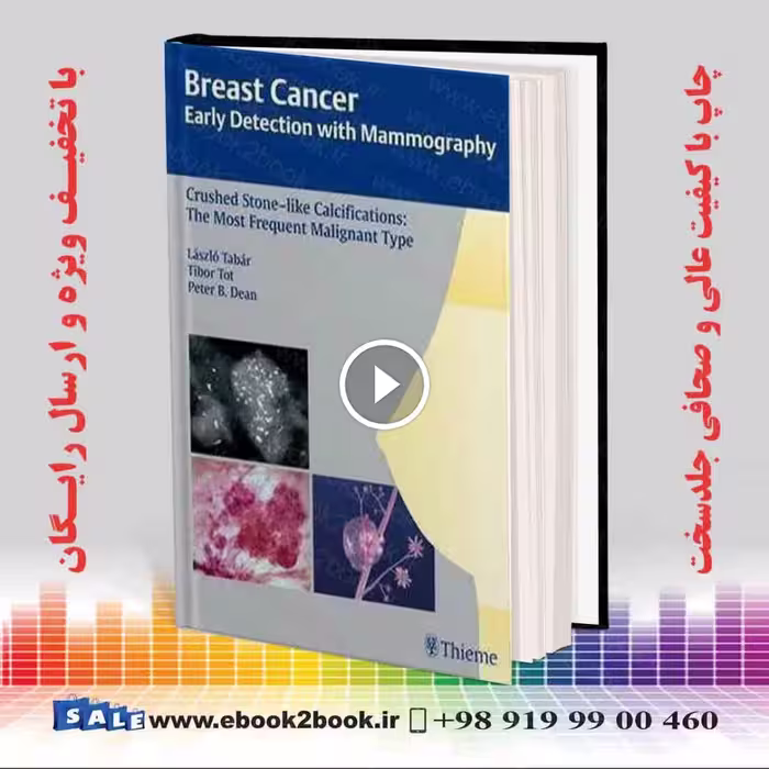 Breast Cancer: Early Detection with Mammography