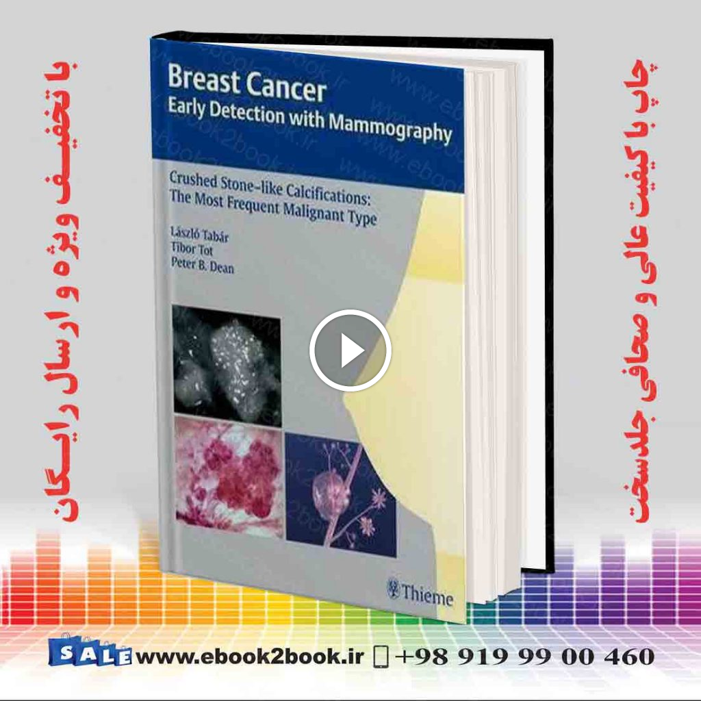 Breast Cancer: Early Detection with Mammography