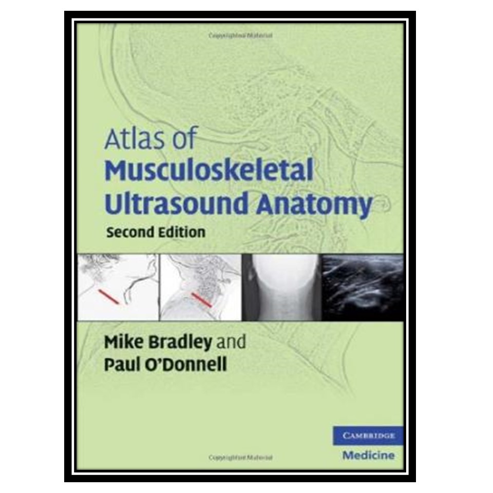 کتاب Atlas of Musculoskeletal Ultrasound Anatomy اثر Mike Bradley and Paul ODonnell انتشارات مؤلفین طلایی
