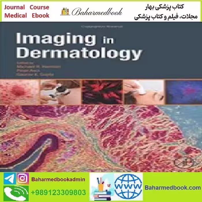 Imaging in Dermatology TRUE PDF price 1€ - کتاب پزشکی بهار