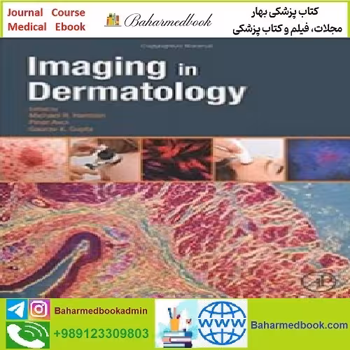 Imaging in Dermatology TRUE PDF price 1€ - کتاب پزشکی بهار