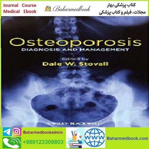 Osteoporosis Diagnosis and Management TRUE PDF price 1€ - کتاب پزشکی بهار
