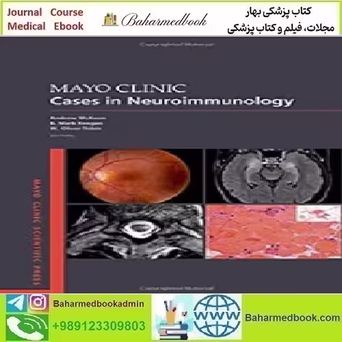 Mayo Clinic Cases in Neuroimmunology 2022 TRUE PDF price 1€ - کتاب پزشکی بهار