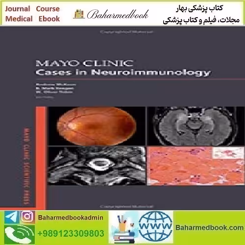 Mayo Clinic Cases in Neuroimmunology 2022 TRUE PDF price 1€ - کتاب پزشکی بهار