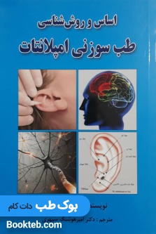 اساس و روششناسی طب سوزنی امپلانتات