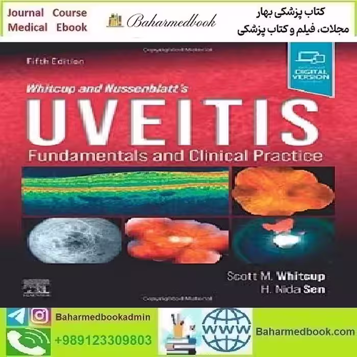 Whitcup and Nussenblatt's Uveitis Fundamentals and Clinical