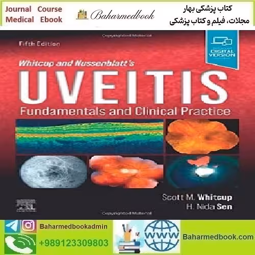 Whitcup and Nussenblatt's Uveitis Fundamentals and Clinical