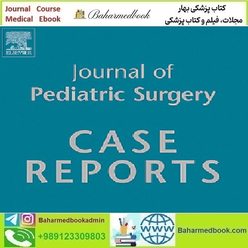 Journal of Pediatric Surgery Case Reports Volume 52 to 63 2020 T