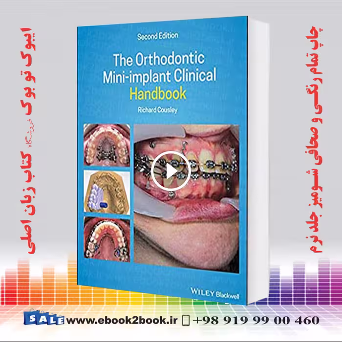 The Orthodontic Mini-implant Clinical Handbook 2nd Edition