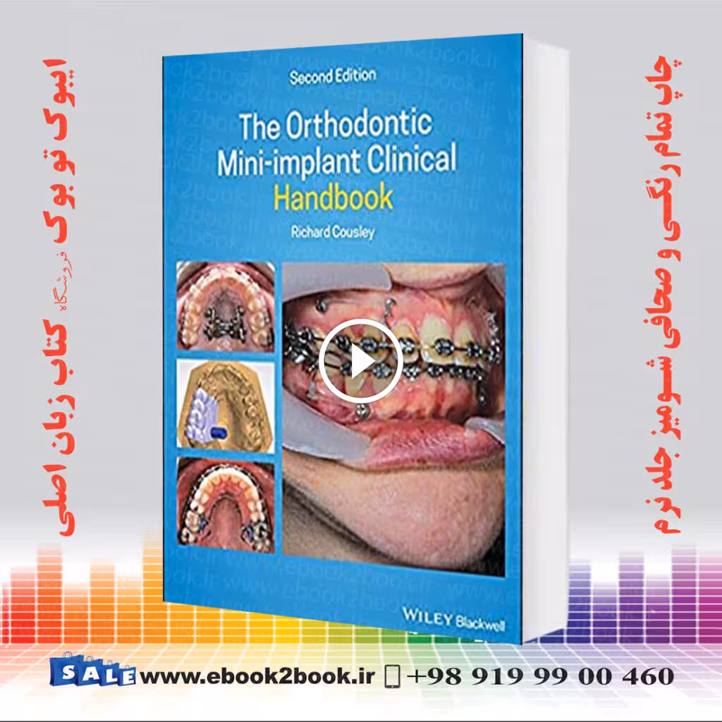 The Orthodontic Mini-implant Clinical Handbook 2nd Edition
